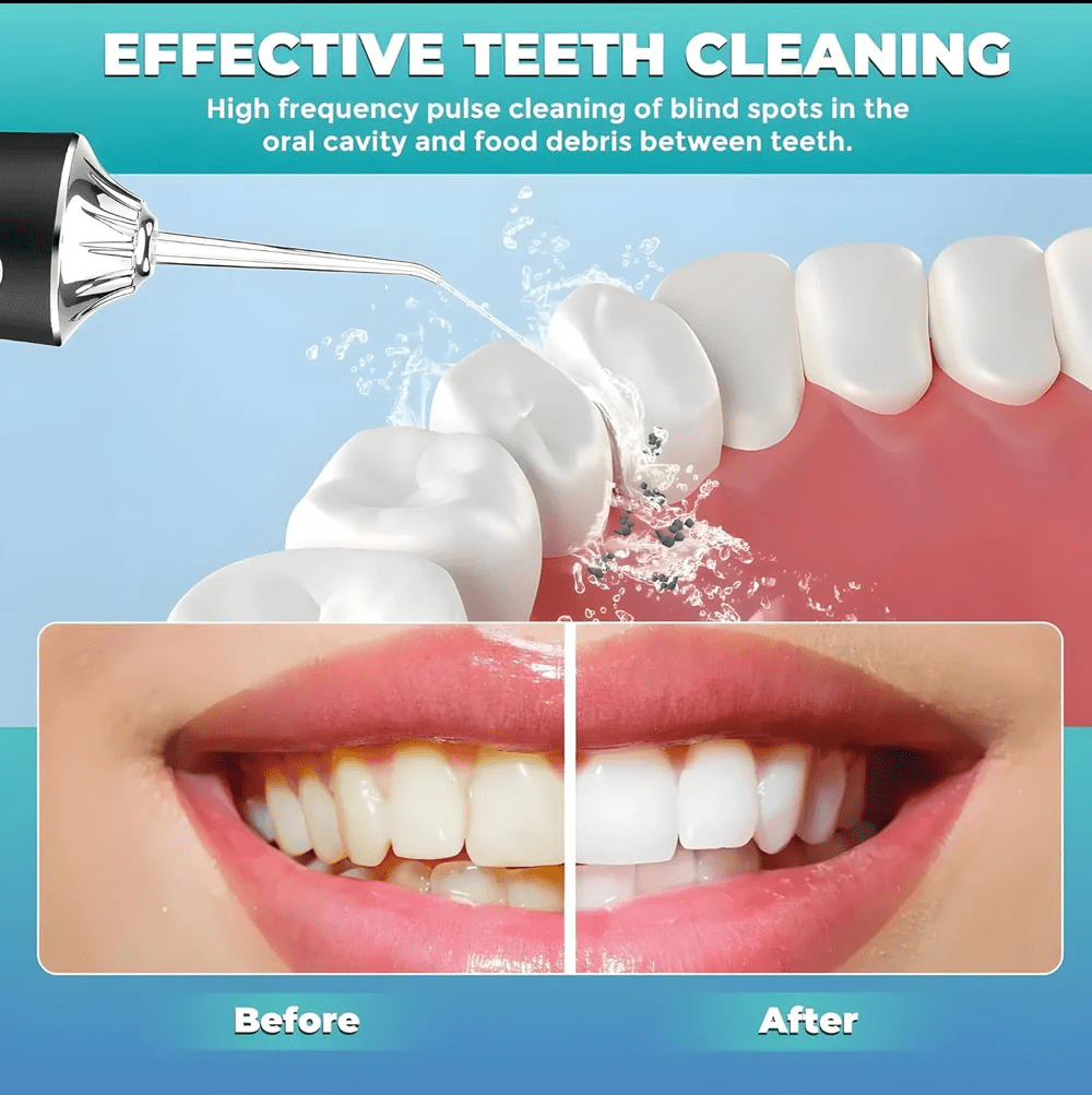 Water Flosser Portable Dental Water Jet Oral Teeth Irrigator Waterproof Tooth Cleaner Water Flosser Oral Flosser 3 Modes And 4 Nozzels