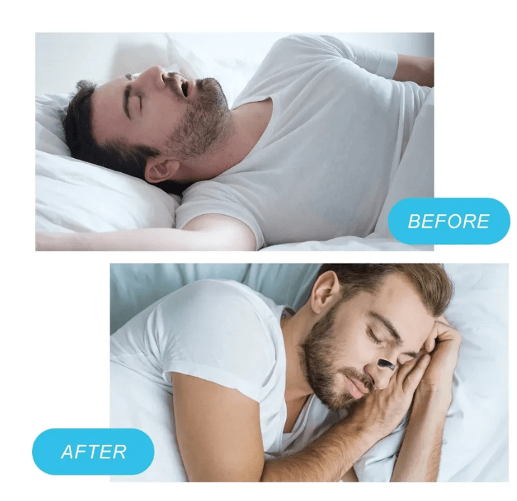 Magnetic Nasal Strips